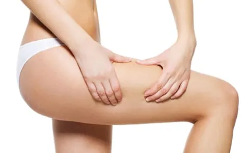 tratamientos para la celulitis: cómo eliminarla y mejorar la piel