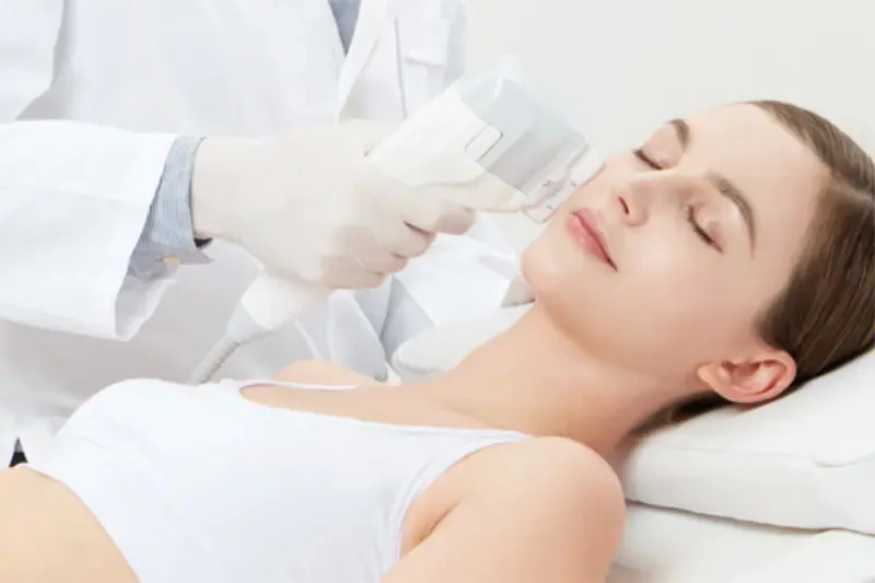 Ulfit facial: efecto lifting sin cirugía